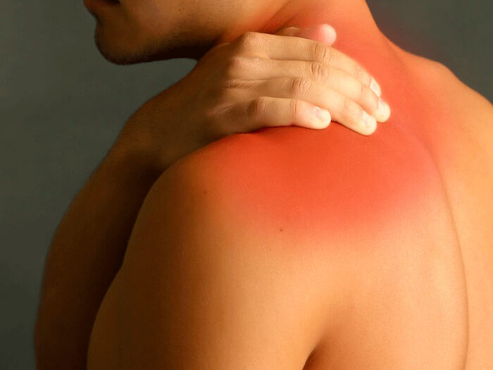 artrosi_spalla_chirurgia_prevenzione_centro_nazionale_artrosi